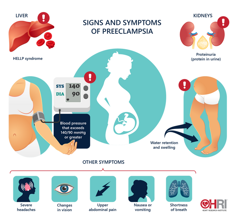 Preeclampsia signs, symptoms and treatment • Heart Research Institute